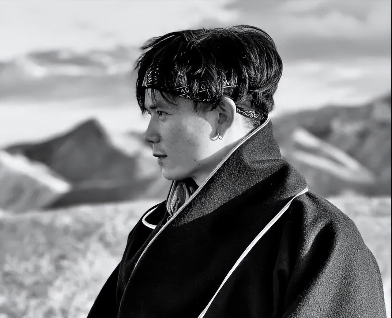 谈痣色变,身上长的痣都是色素痣吗