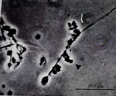 uu感染是什么意思,uu感染严重吗