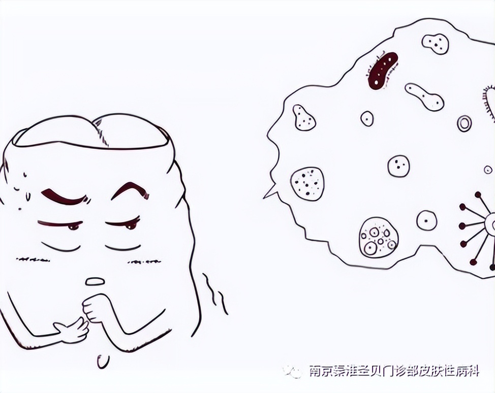 尖锐湿疣激光治疗影响精子质量吗,尖锐性湿疣治疗用什么方法最好