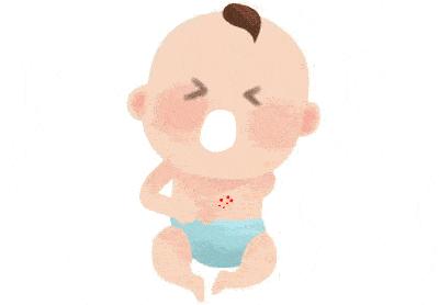 新生儿湿疹的最快最有效土办法,新生儿湿疹怎么去除最简单方法