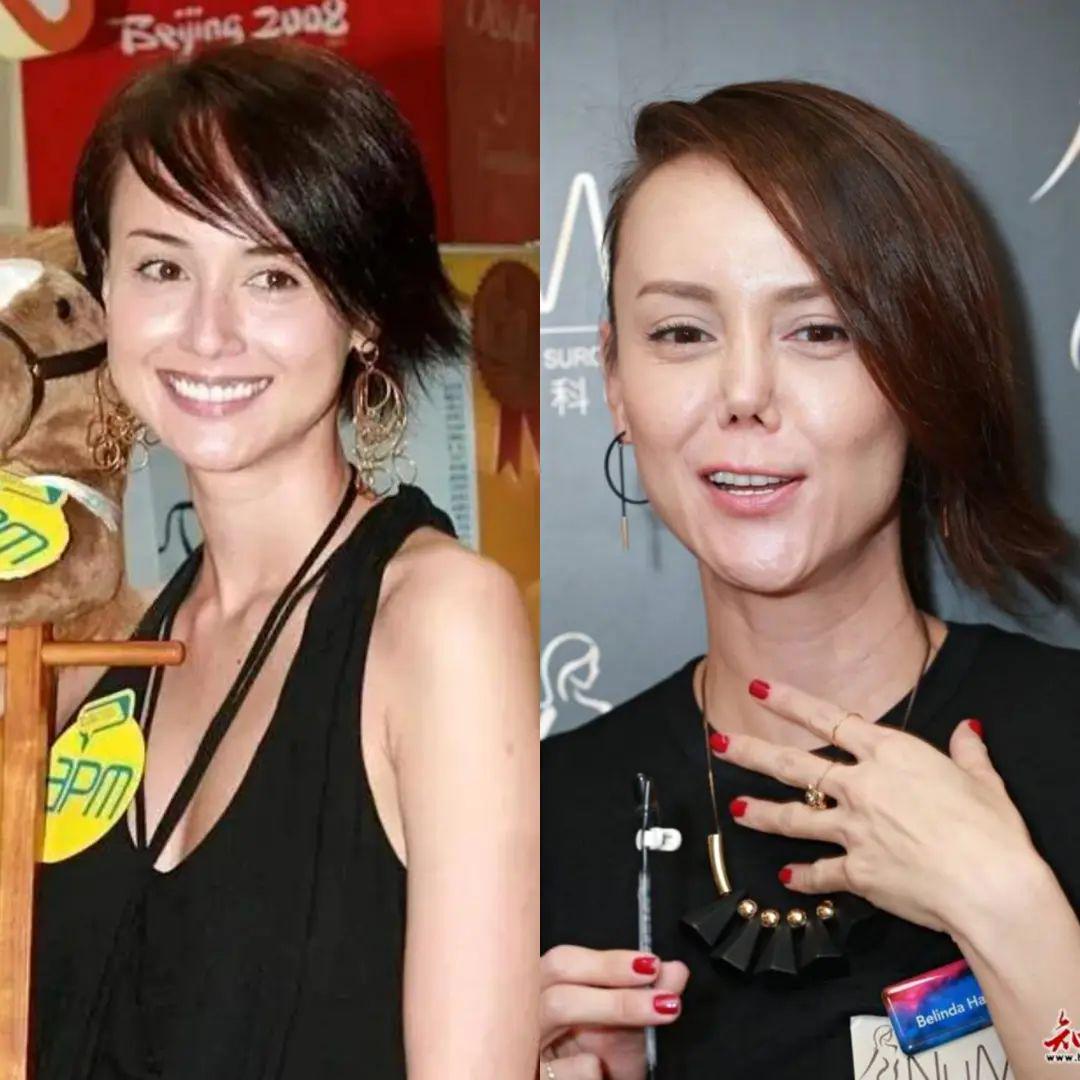 她曾是选美大赛冠军,她曾是选美冠军