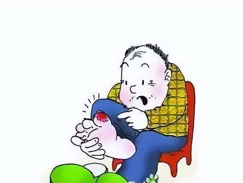 糖尿病足防治注意事项,糖尿病足有治疗指南或诊疗规范吗