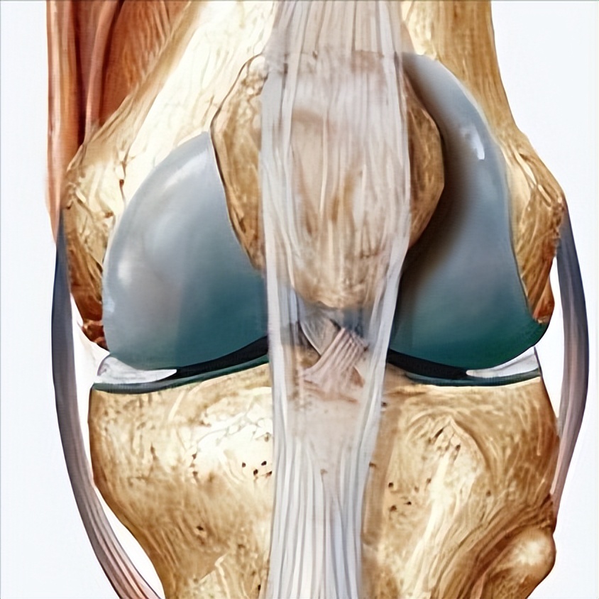 儿童股骨干粉碎性骨折对位不太好,儿童股骨干骨折石膏固定