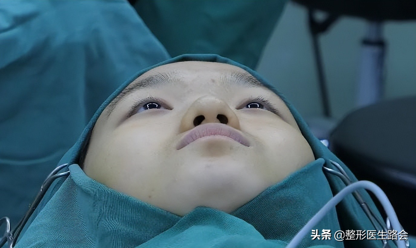 全脸整形记录恢复过程,女孩整形全过程