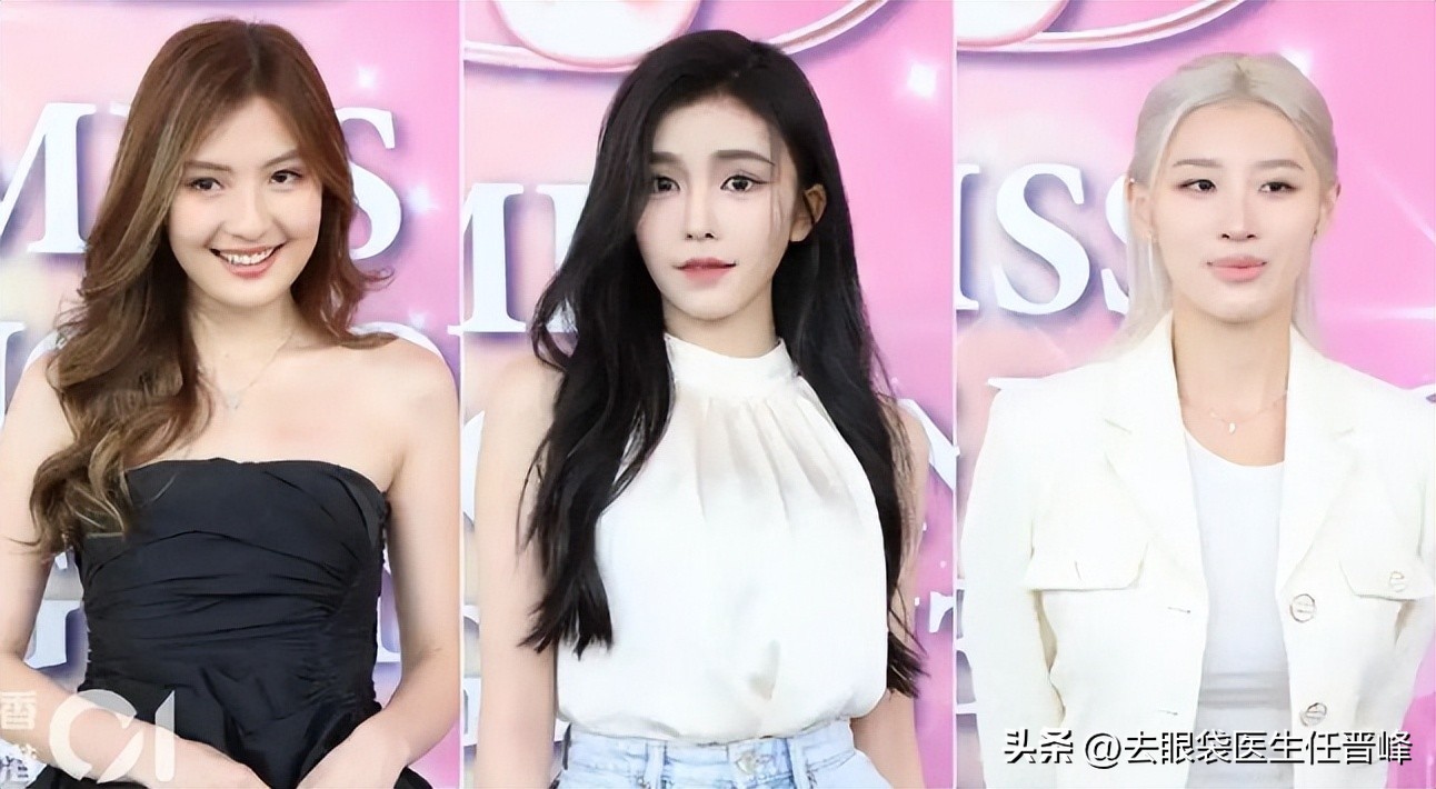 三甲医生大公开，“神颜港姐冠军”拥有这几点，也也可以很美