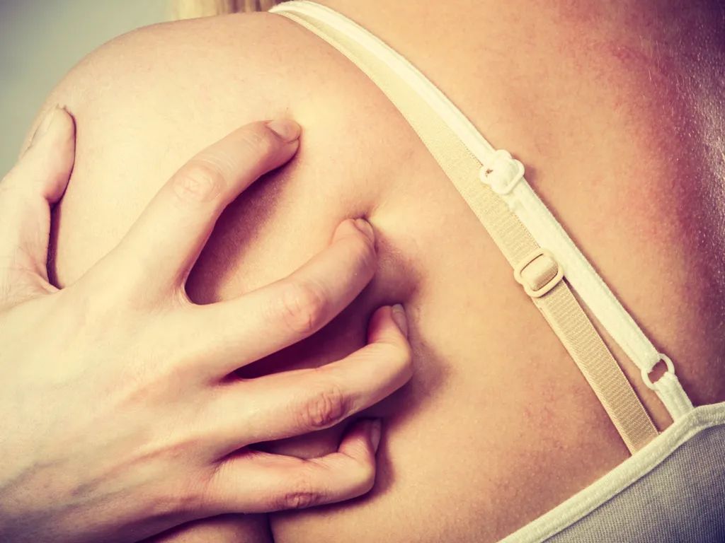 什么是湿疹湿疹是如何产生的,湿疹是什么原因造成的湿疹怎么治