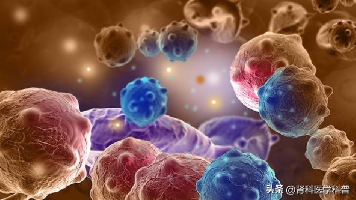 肾感染并脓肿形成怎么处理,肾皮质脓肿怎么诊断