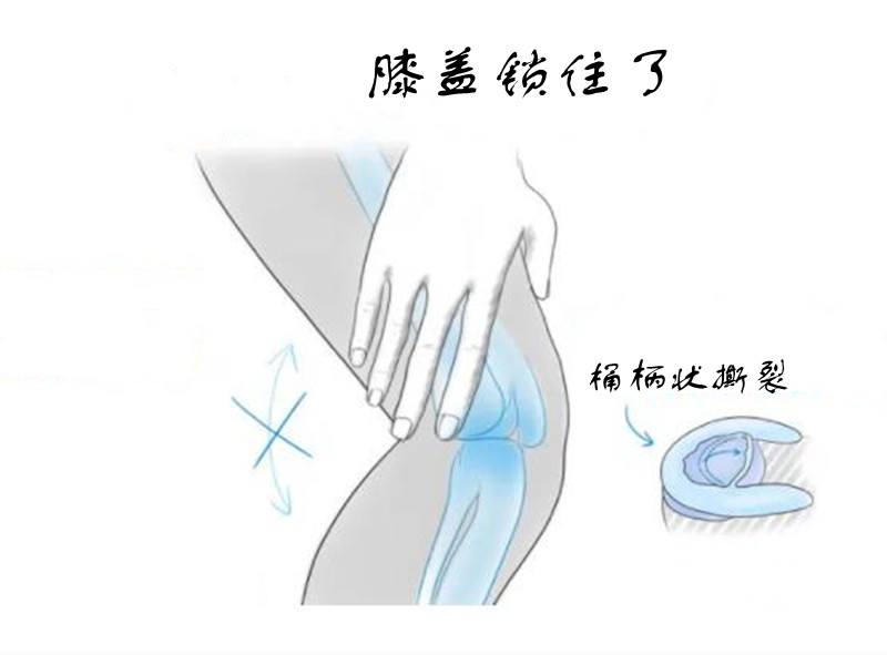 膝盖受伤要不要去包扎,膝盖受伤不能弯曲是什么问题