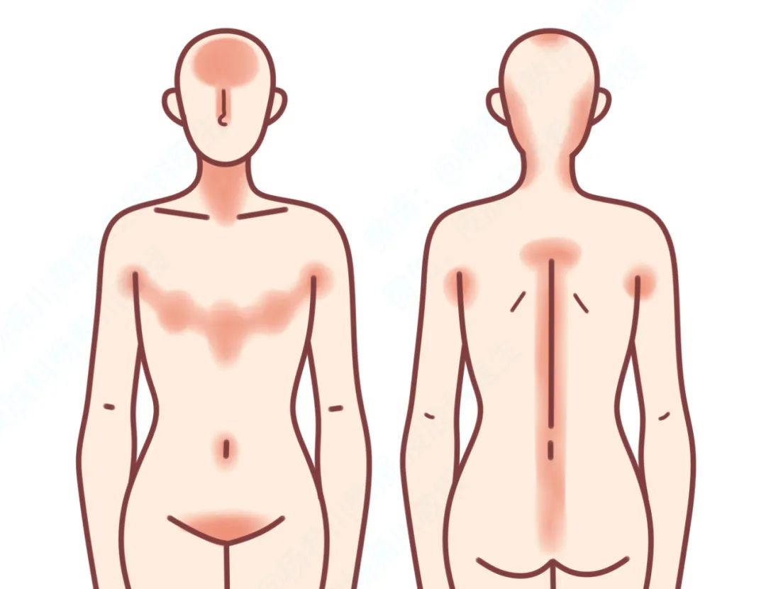 皮肤洗不干净老是脱皮,不洗澡身上晒得脱皮了怎么办