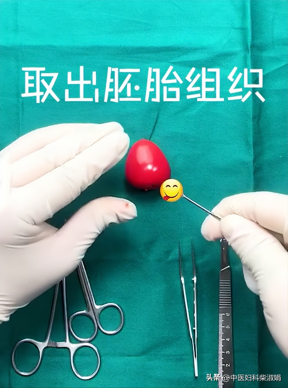 一组图，揭秘人流后的子宫状态，结果太直观了