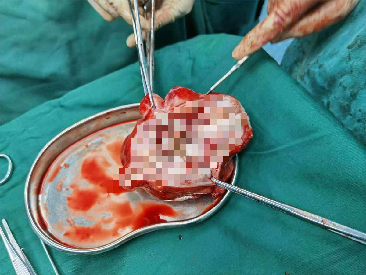 医院内让人脸红的“妇科检查”，医生：这2类人不愿意也要做？