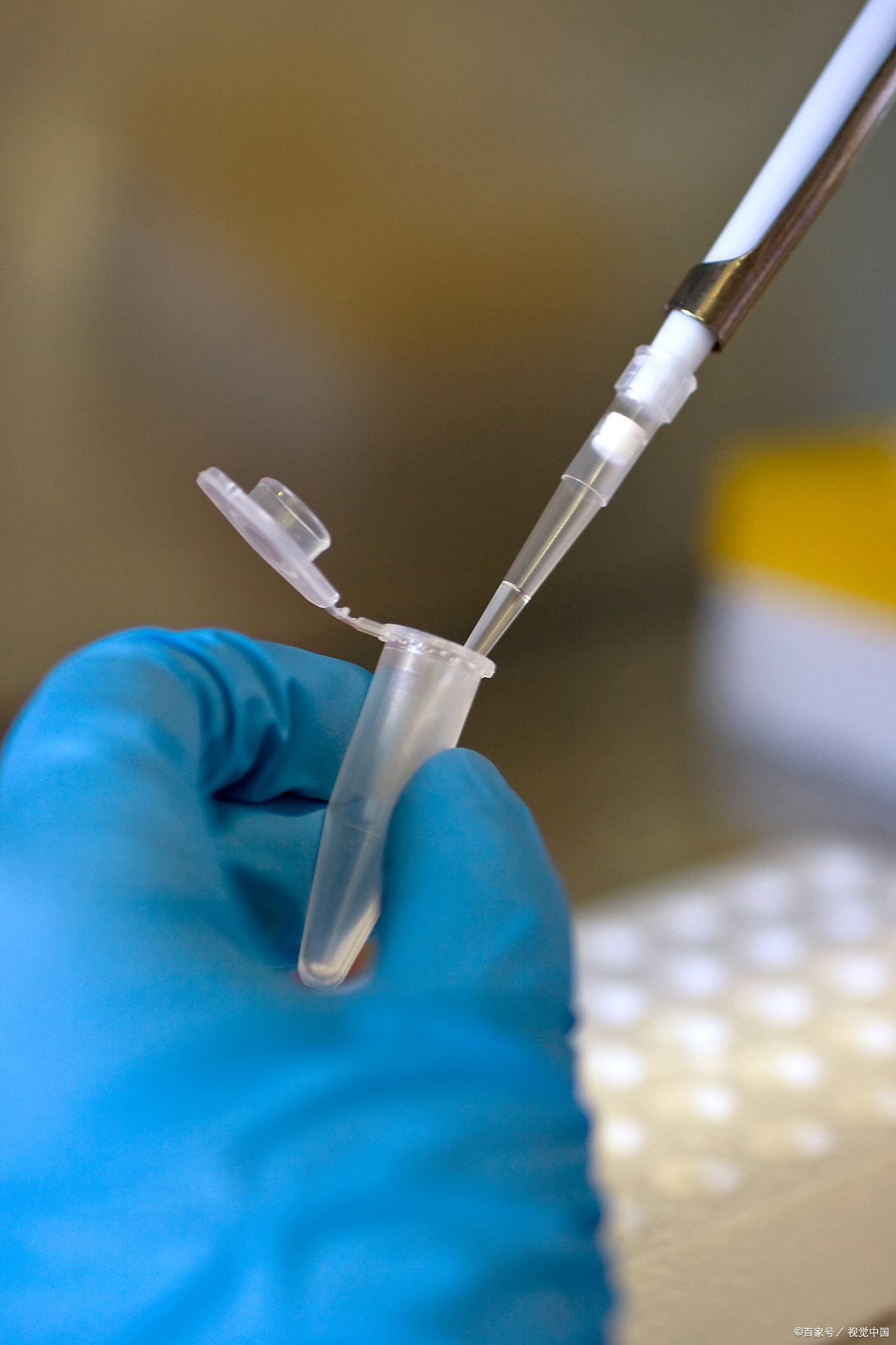 血液科基因检测的作用与意义,血液基因检测技术