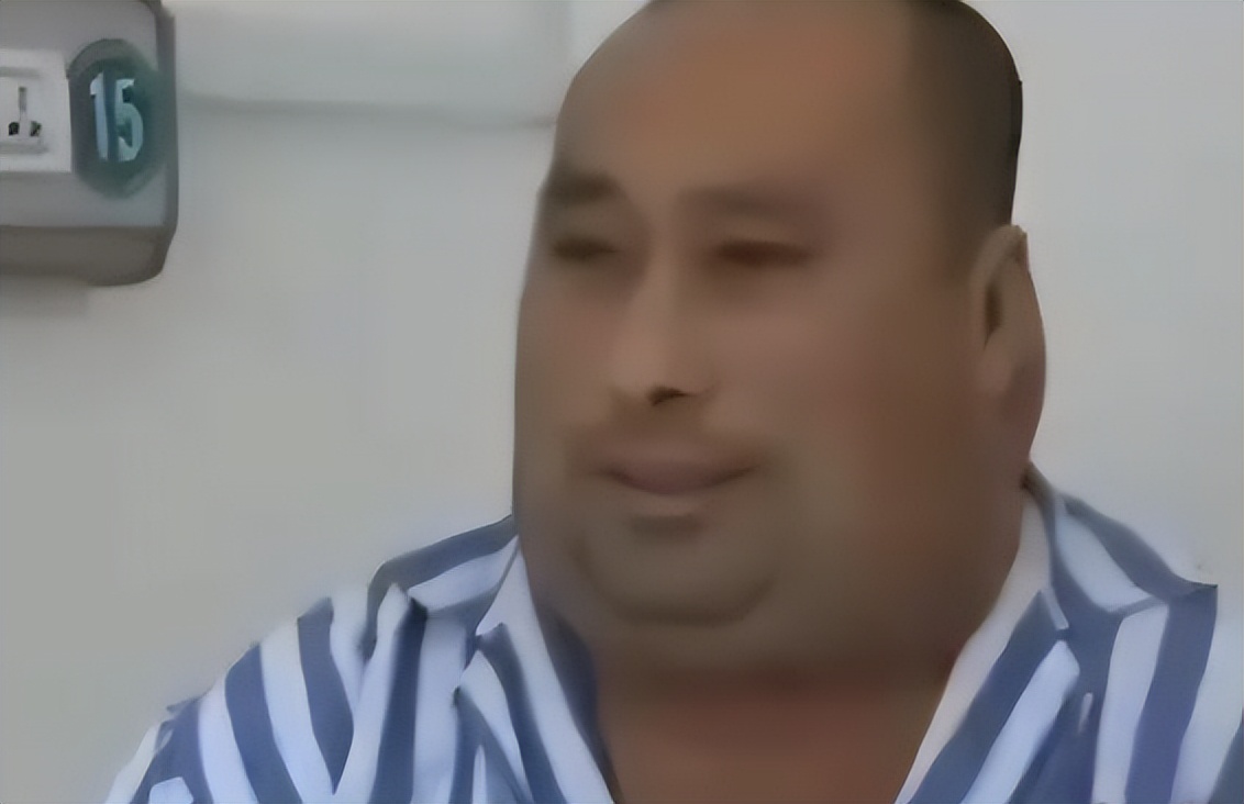 62岁大叔喝出河马脖,辽宁男子喝酒成河马