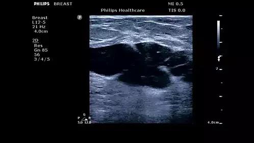 飞利浦philipscvr708,飞利浦philipsspt6627测评