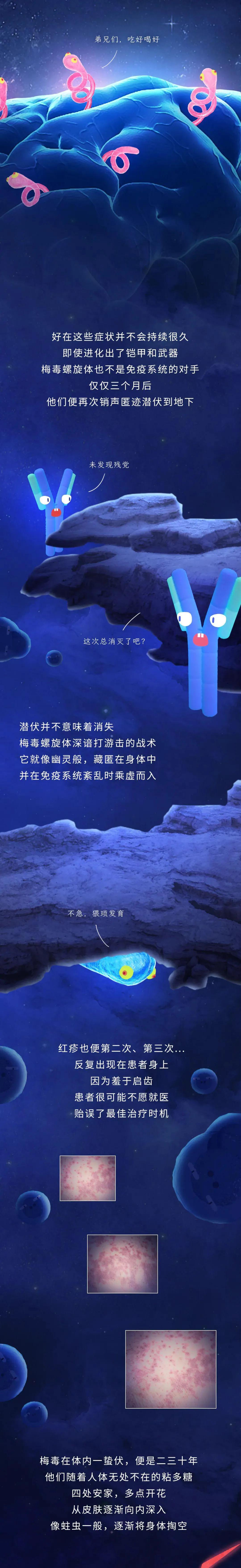神经梅毒痛苦程度,梅毒患者打青霉素痛苦吗