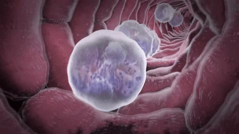 核辐射死掉了多少人,核辐射死亡真实事情