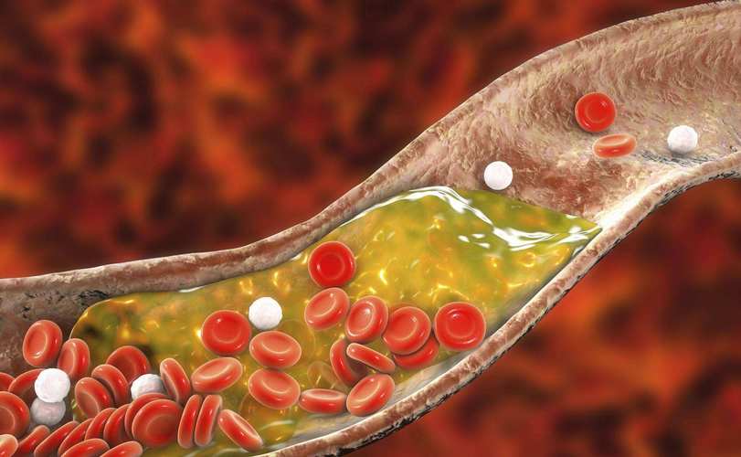 猪油是营养品还是心血管杀手,一勺猪油等于五副药