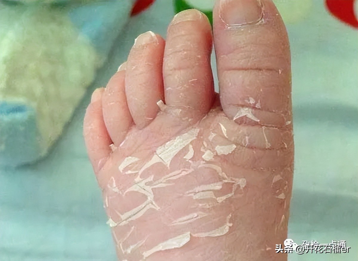 新生儿这28个异常表现都是正常的,新生儿值得注意的各种症状