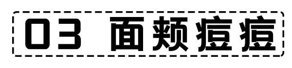 面部危险三角区反复起痘痘怎么办,脸颊周围痘痘的正确消除方法