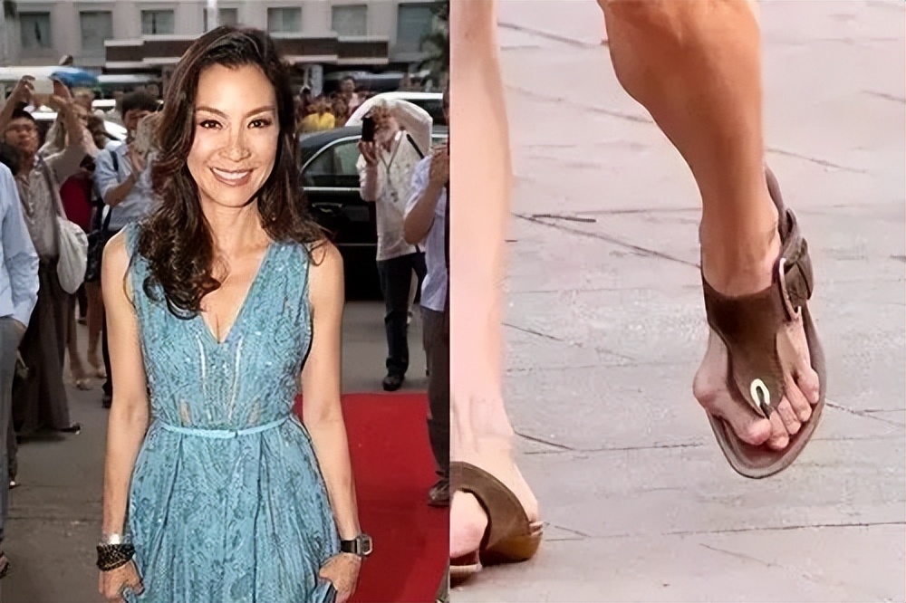 大脚拇外翻走路如何矫正,大脚趾歪了怎么矫正