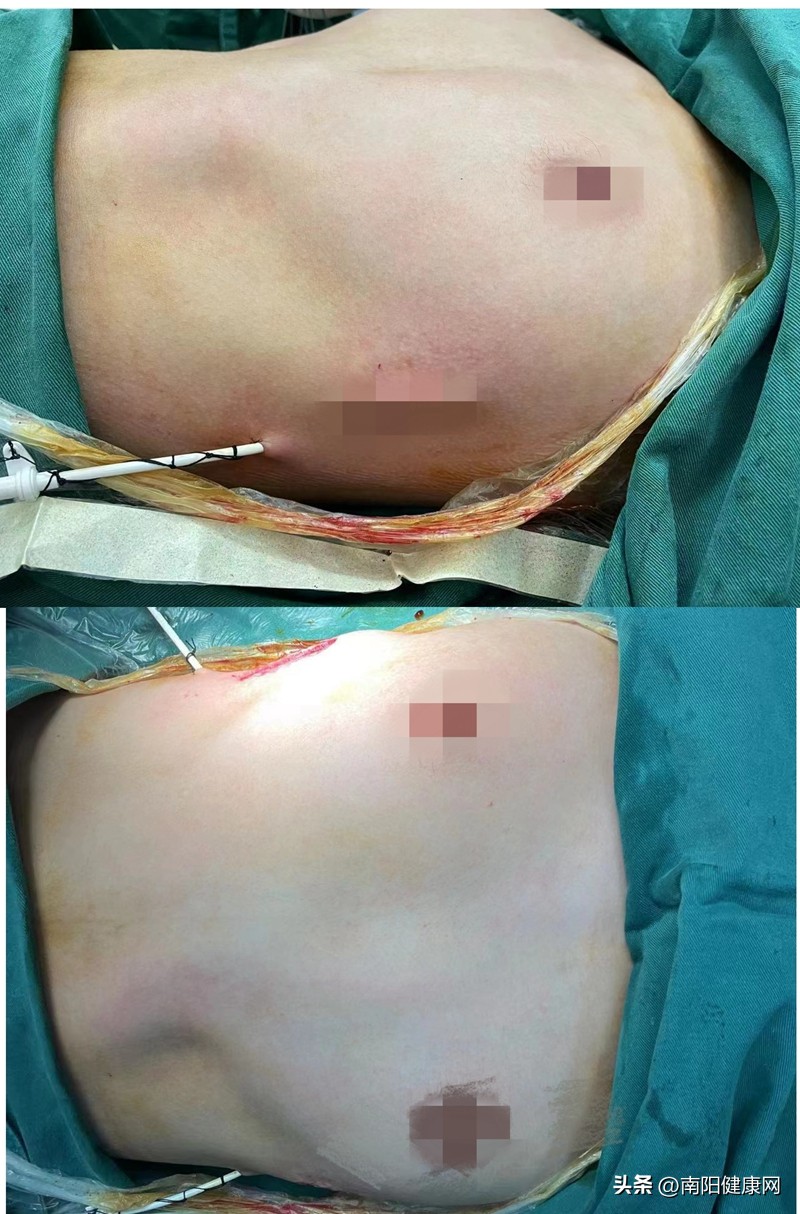 关注青少年健康成长活动策划,关注青少年健康成长直播回放