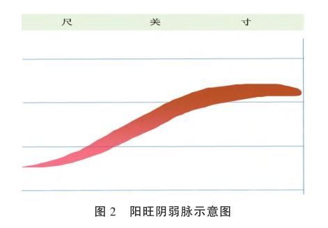 中医内科消渴病辨证分型,消渴症方解