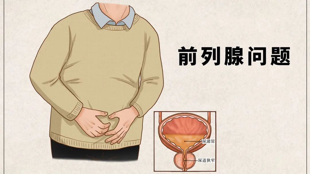 前列腺彩超憋尿吗,经直肠前列腺彩超