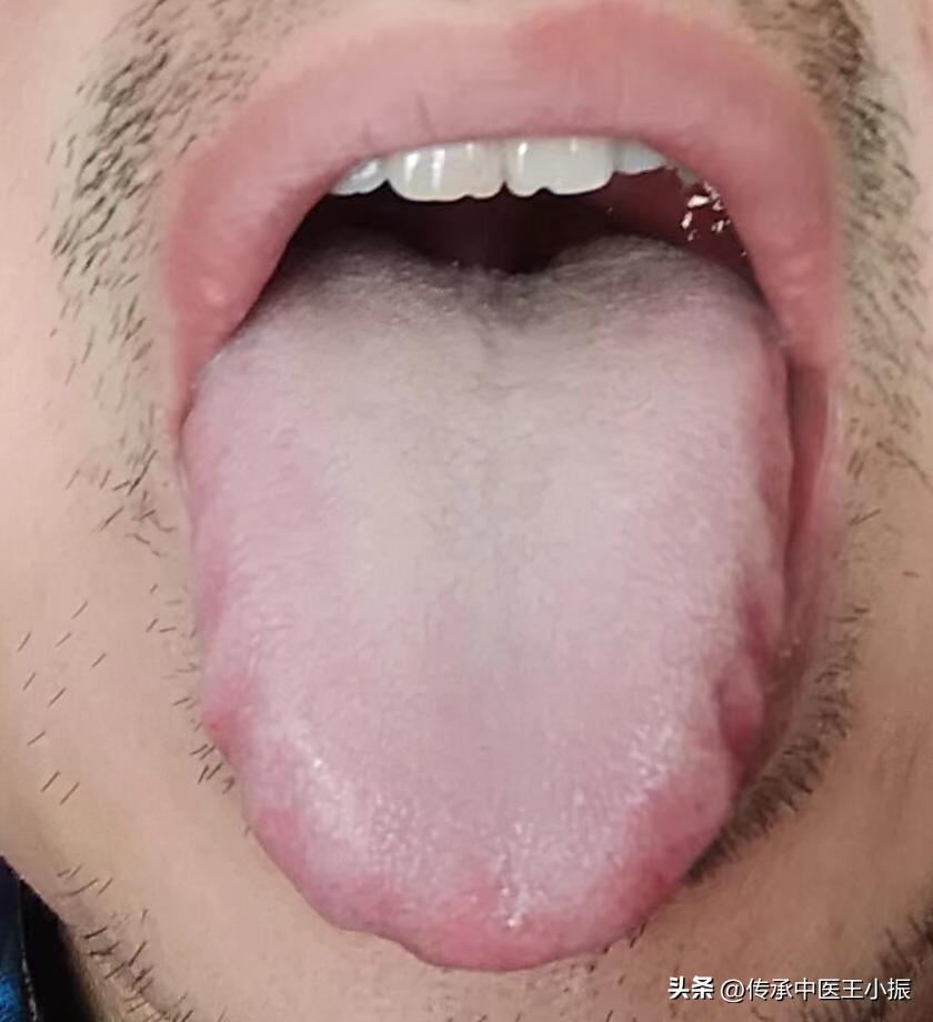 双腿如灌铅般沉重什么意思,双腿酸软僵硬走路无力的训练方法