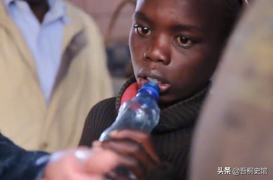 非洲男孩每天喝“胶水”，终日与蚊子相伴，被人称为“僵尸男孩”