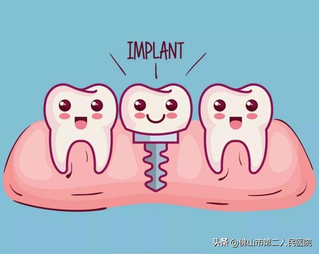 种植牙降价文章,种植牙的内幕你了解多少