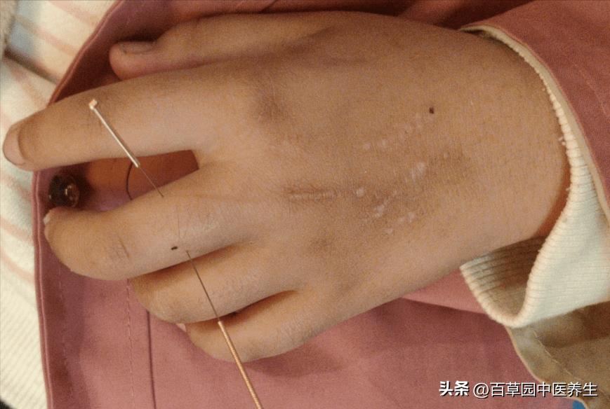 女童惊吓,4岁孩子受了惊吓去医院怎么治疗