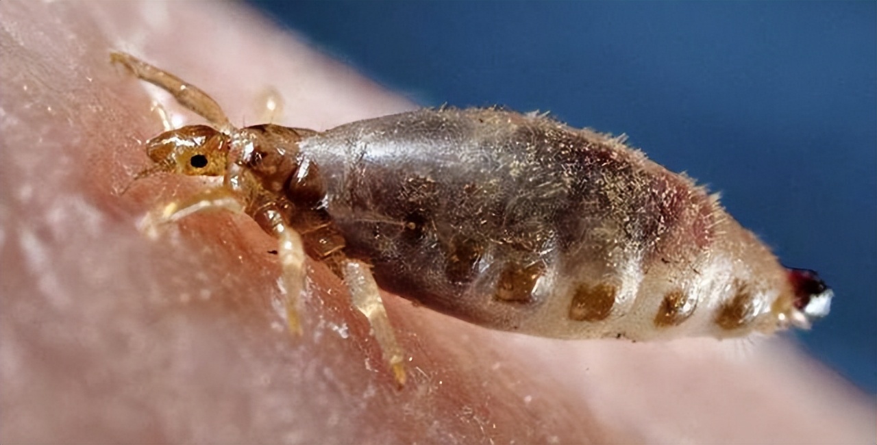 和人类共同进化的虱子，30多年前很常见，现在怎么看不到了？