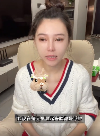 女网红整容变化,整容失败女网红对比