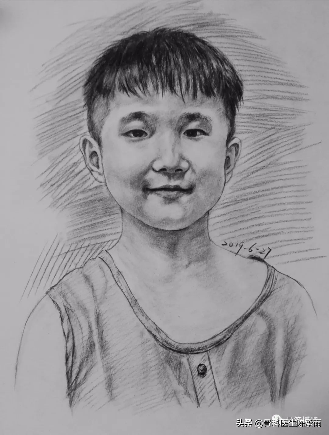 膝关节2度损伤需要做关节镜吗,膝关节常见损伤的检查方法