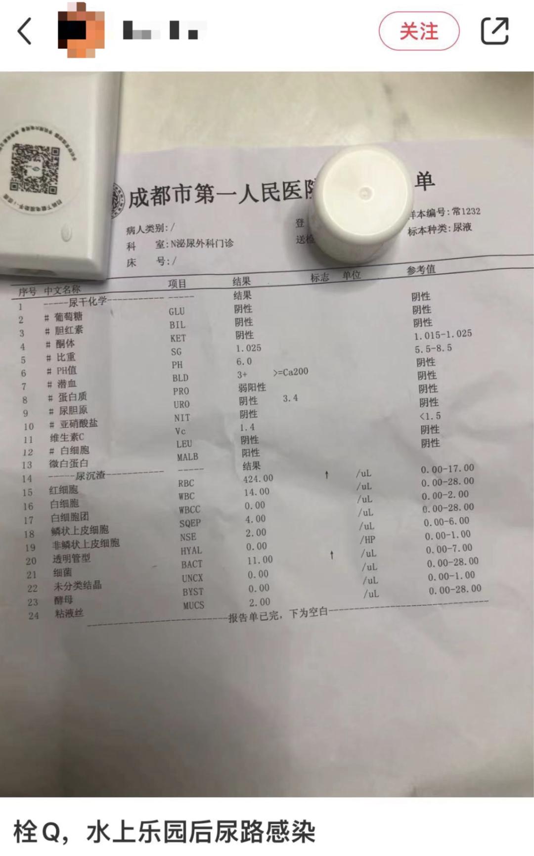 去水上乐园泳池游泳会得妇科病吗,玩水上乐园怎么避免妇科病传染