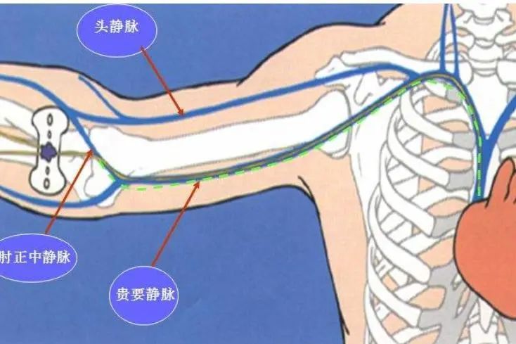 不扎肉肉、不咋疼、方便又实惠的“输液通道”,究竟是何方神圣?