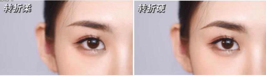 眉毛不对称怎么办可以整容吗,脸圆眉毛淡怎么修剪