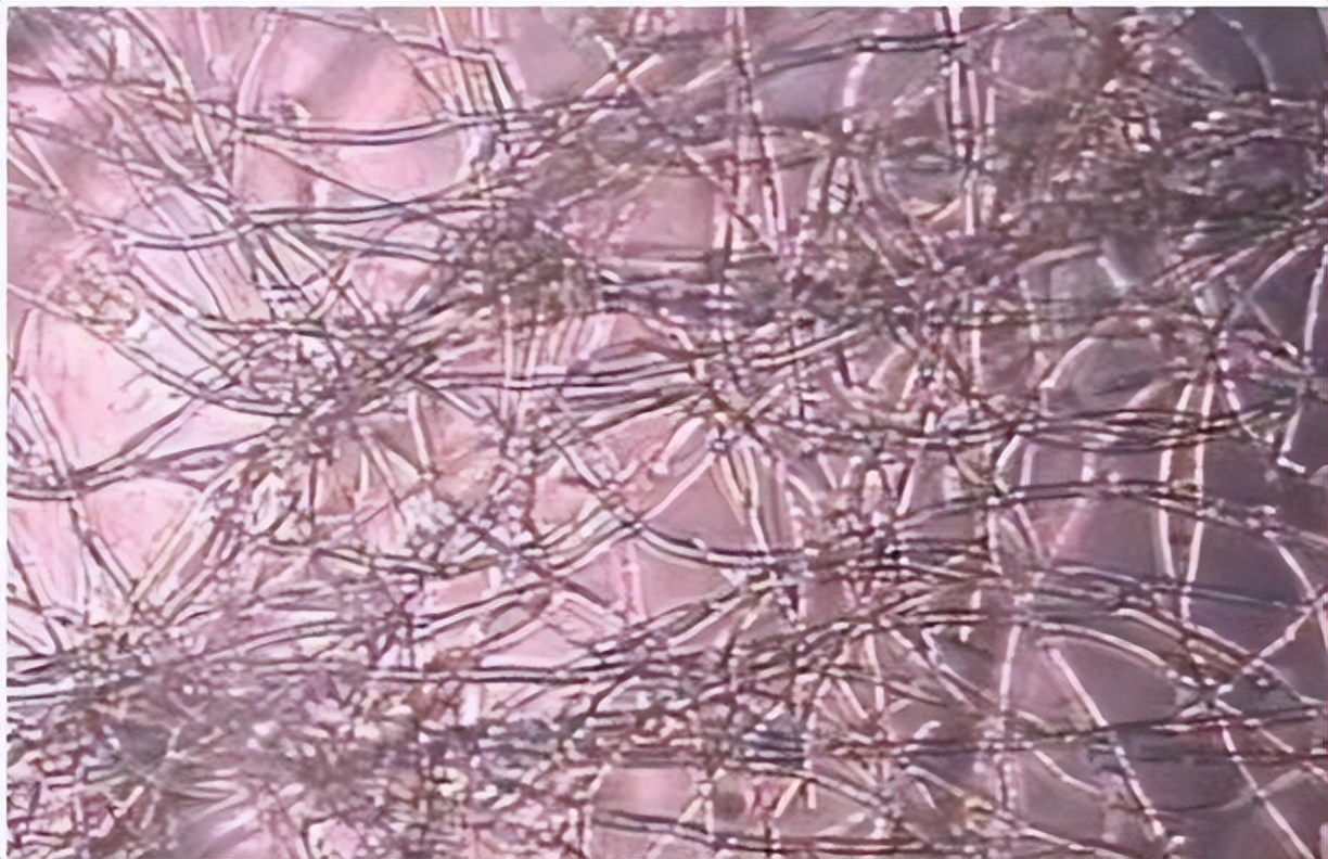 金黄色葡萄球菌的微生物特性,金黄色葡萄球菌的培养特性