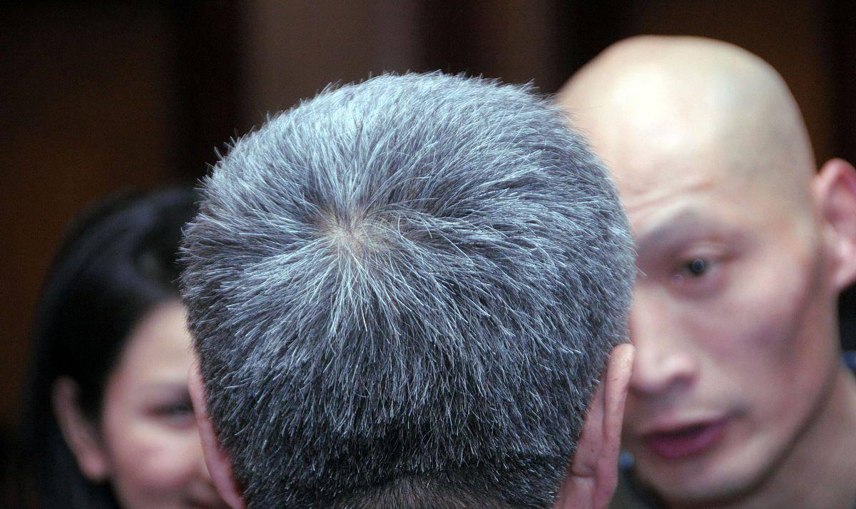 白发长在头中间预示什么病,孩子两鬓和后脑勺白发是什么原因