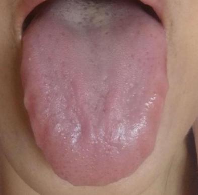 失眠4种中成药解决你的睡眠难题,失眠彻底治愈的七大方法