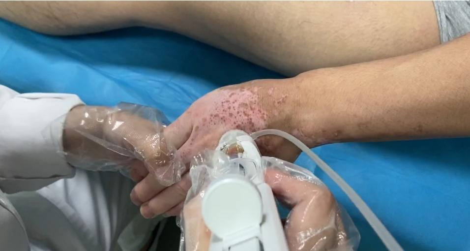 白癜风吃药控制住不复色行吗,白癜风不吃药的后果