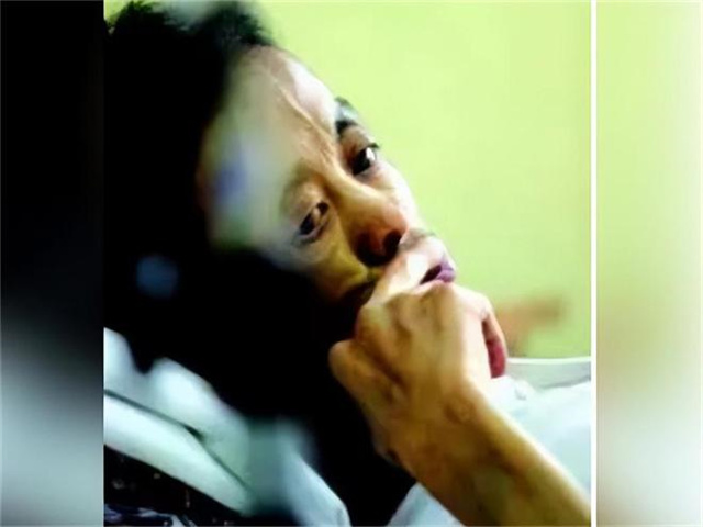 因为安乐死杀人的案例,被判安乐死案例