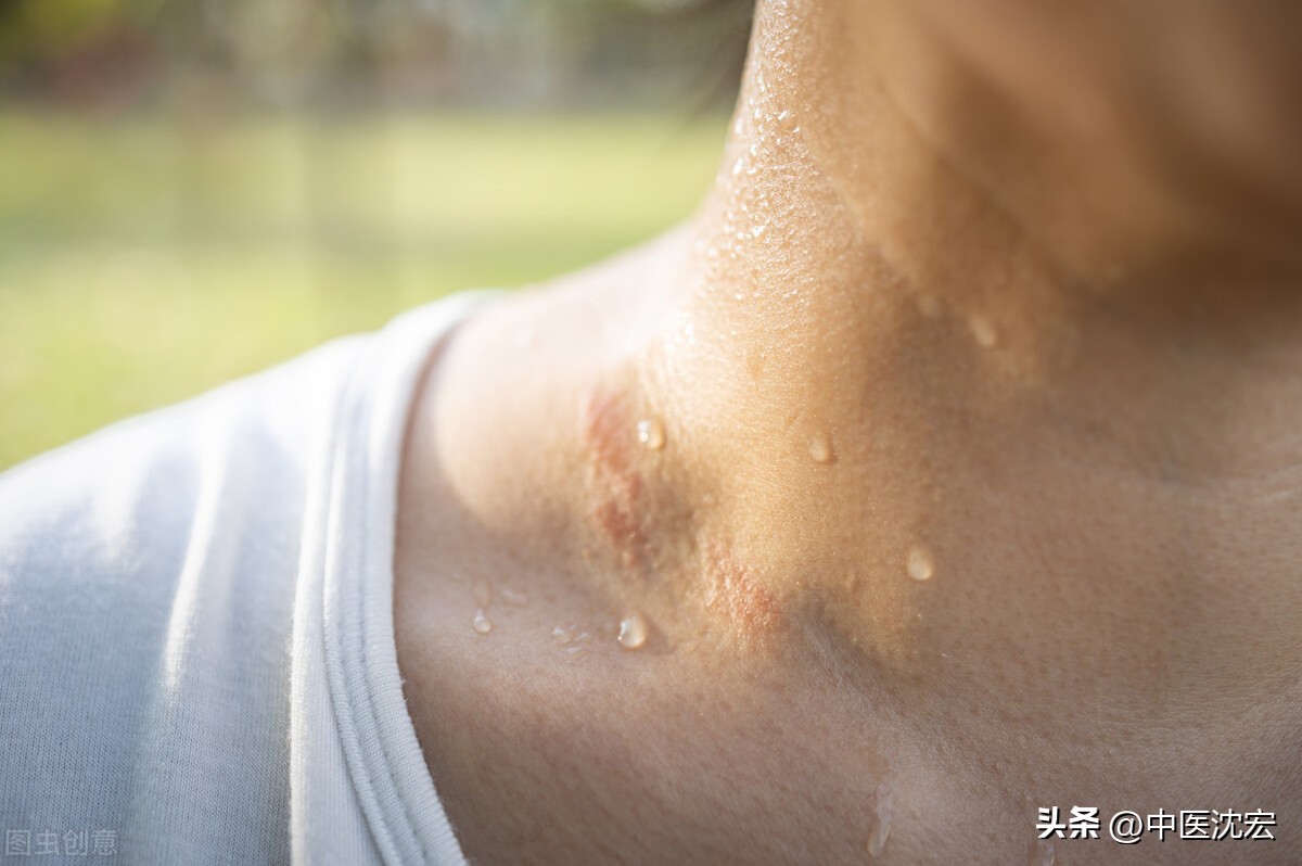 出虚汗是什么病,出虚汗是什么病的前兆