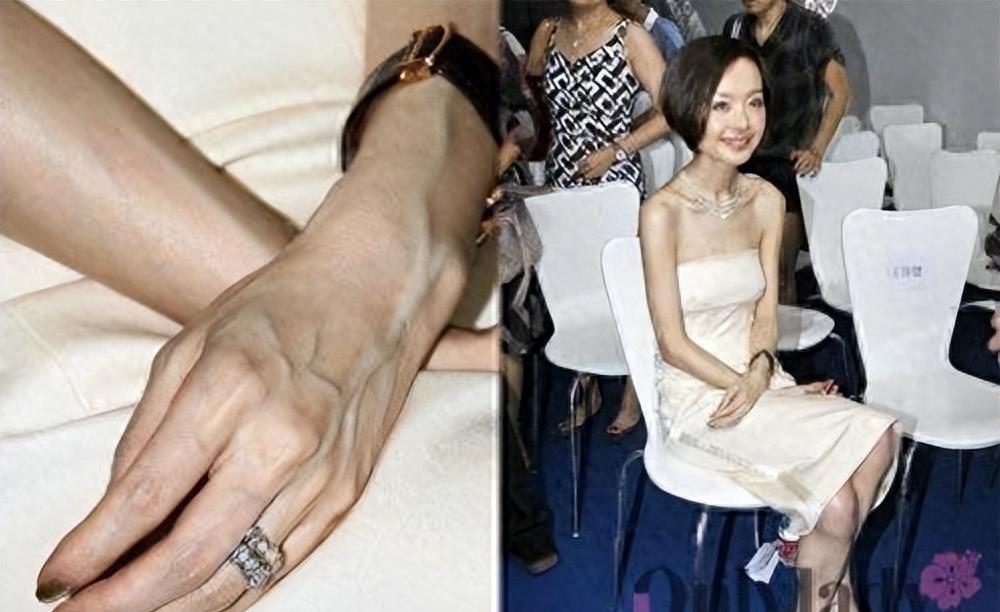 瘦到病态的审美,瘦到病态