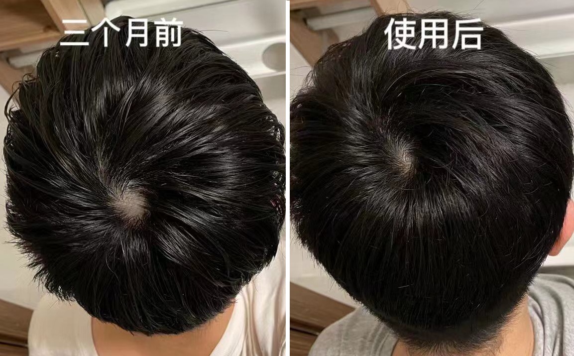 双11必买清单配饰,推荐双11必备好物