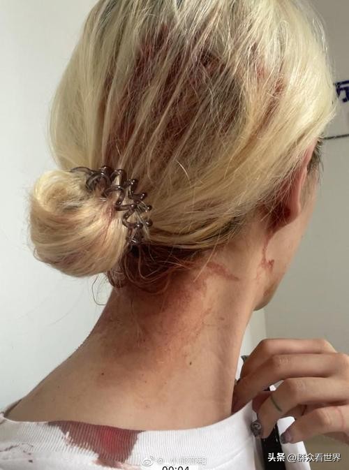 男友暴力倾向怎么办,男友暴力倾向连自己都打