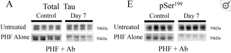 tau鎶椾綋,tau鎶椾綋涓村簥璇曢獙