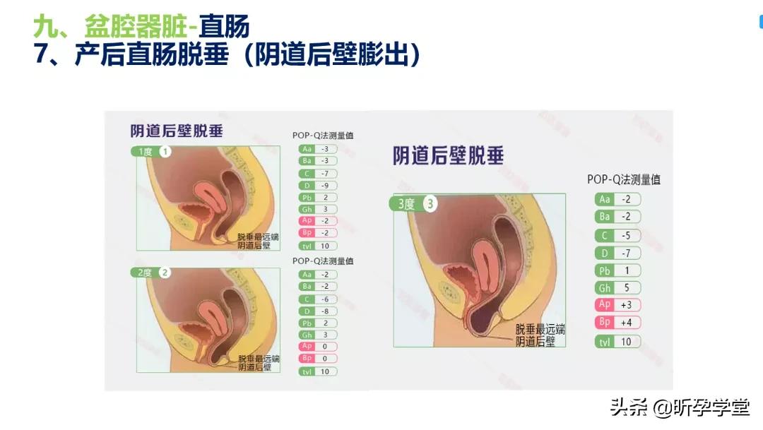 盆底肌修复紧致瑜伽,盆底肌修复瑜伽私教