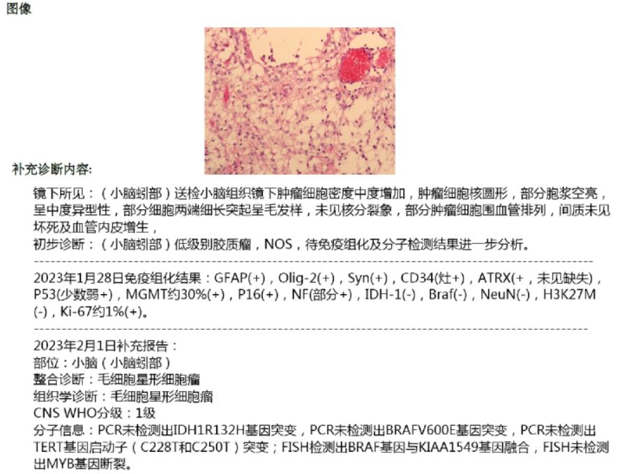 孩子恶心要警惕四种病,孩子脑肿瘤造成恶心呕吐