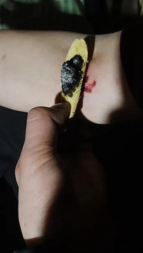 养狗人是怎么处理被狗咬到的,养狗被自家狗咬伤了怎么办